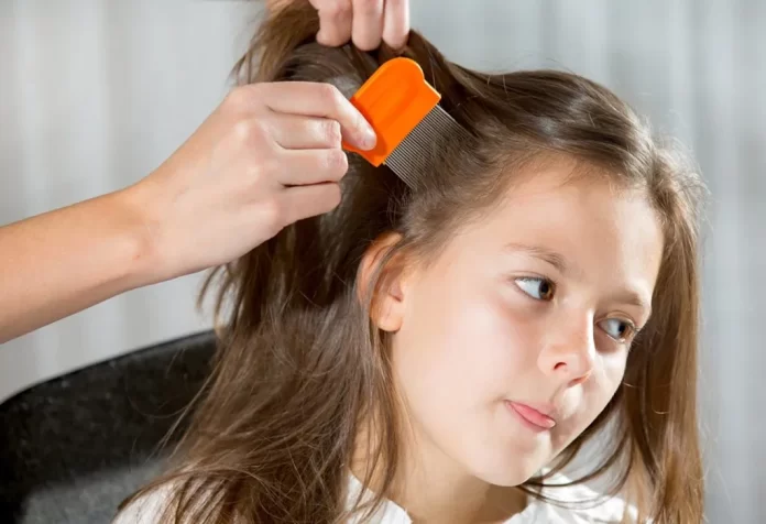 how to get rid of lice naturally in one day